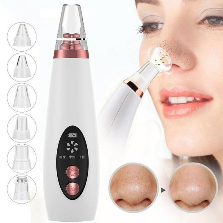 Blackhead Remover Vacuum – Electric Pore Cleaner & Acne Extractor for Nose & Face | Suction Tool for Deep Cleansing & Skin Care